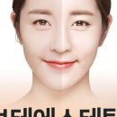 보테에스테틱 이미지