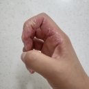 호감한의원 | 비누공방 창업 반, 자운고 카렌듈라 인퓨즈 오일 후기!