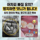 고앤박치과의원 | 유치는 어차피 빠진다는데... 꼭 치료해야 할까요? 부모님이 가장 헷갈려하는 기준