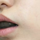 중앙의료기 | 링클백 팔자 요가 구륜근 리프터 후기