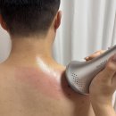 애프터 핏 | 야노시호 픽, 웰247 바디컷튠핏 V2 흡입괄사 등관리 후기 (비포/에프터)