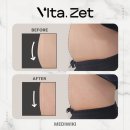 메디위키 이미지