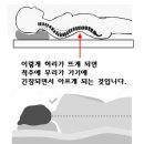 허리 디스크가 온건지 허리가 아파서,침대 매트리스 교체 이미지