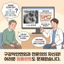 서울365열린치과의원 | [화도상악동거상술] 뼈가 1mm도 안 남았다고요? '측방 접근법'으로 뼈 만들어서 심은 후기