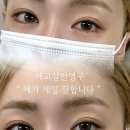 영구언니 | 애교살 반영구 만족한 후기