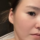 마일드팜 | 팜올로지 스킨리셋드롭 에스테틱화장품 사용 전후 후기