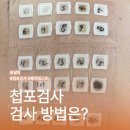 N.P치과기공소 | 피부 알레르기 원인 찾기, 지연성 알레르기 첩포검사(Patch Test) 방법 반응 후기 결과 총정리
