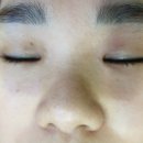 아중건강약국 | 인덕원 피부관리 플로라스킨케어 플로라작은얼굴 관리 효과짱입니다