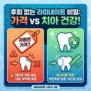 스마트치과기공소 | 라미네이트 비용과 치아 삭제량의 비밀! 저렴한 가격보다 먼저 따져야 할 실패 없는 핵심 기준 5가지