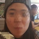 스노우의원 이미지