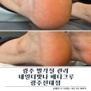 빛나 | 광주 발각질 관리 전대 네일더빛나 솔직후기