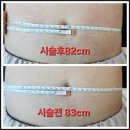 (주)네오메디칼 | 빼라피2, 빼라피네오 국내출시!