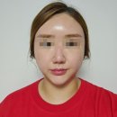 다인스킨케어 | 구미 피부관리 다인스킨케어 가을시즌케어 숨결클렌징 후기