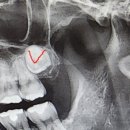 수성사랑니치과의원 이미지
