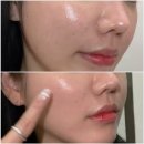 아셀 - 안양시 동안구 평촌대로374번길 9-7 | 마포피부과 쥬베룩아이·쥬브아셀 후기