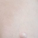 아이앤유 이미지