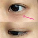 아이백에 직빵! 아이엘엘엠엠 튜브셀 세럼 8주 리얼 후기