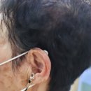 딜라이트보청기 광주점 이미지