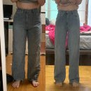 지방 | 다리 지방흡입후기(청라비만클리닉, 5주차 멍&amp;붓기 변화)