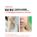 라온핏 | 얼굴 볼살 다이어트 온핏 페이스 컷 리프팅 지방세포 제거 리프팅까지!