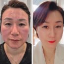 인셀덤신세계