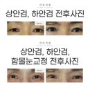 화정현대의원 | 화정상안검수술, 10년이상의 경험과 노하우의 대화동인근성형외과는?