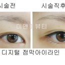아이라인뷰티 이미지
