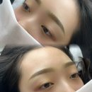 퍼머넌트잉크 | 일산남자눈썹문신, 여기추천합니다