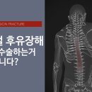 압박골절 후유장해: 허리는 수술하는거 아니다? 이미지