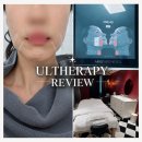 뷰티크레딧비비안피부관리 | 청담동피부과 2년만의 울쎄라 리얼후기, 효과, 붓기
