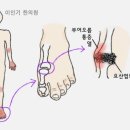 이인기한의원 네이버블로그