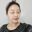 스킨이데아 이미지