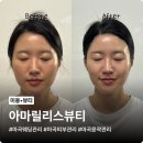 마곡 웨딩관리 아마릴리스뷰티, 안 아픈 수기 윤곽 후기