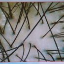 바른인한의원 이미지