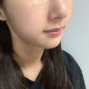원선화에스테틱 | 대구피부관리 원선화에스테틱 만촌동 트로이필 물광피부 후기