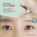 파마짱 이미지