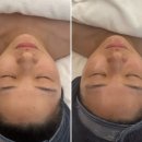 필 | [광주 웨딩관리] 서화에스테틱 :: 웨딩 5주 패키지 3단계 물광필 후기