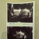 루미나산부인과의원 네이버블로그