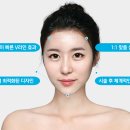 브이라인