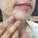 진 메디케어 이미지