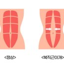 보라필라테스 - 영등포구 대림로8길 39 | 임산부 필라테스 후기 / 복직근 이개 운동 (32주차 임산부의 복근운동 해도될까?)