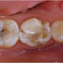 자연미소치과 이미지