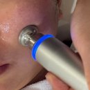 왕지3길 | [후기] LDM관리 받아본 후기 | 순천피부관리 하빌뷰티