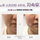 리턴스킨