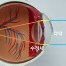 눈닥터안경 이미지