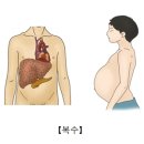 복수로 이미지