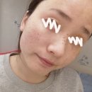 메디힐 마데카소사이드 세럼 크림 흔적세럼 병행 후기