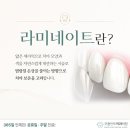 365굿플란트치과의원 네이버블로그