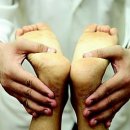 갈라지는 발뒷꿈치 관리법 이미지