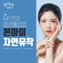 자연유착쌍꺼풀후기 왜 주목받는지 이미지